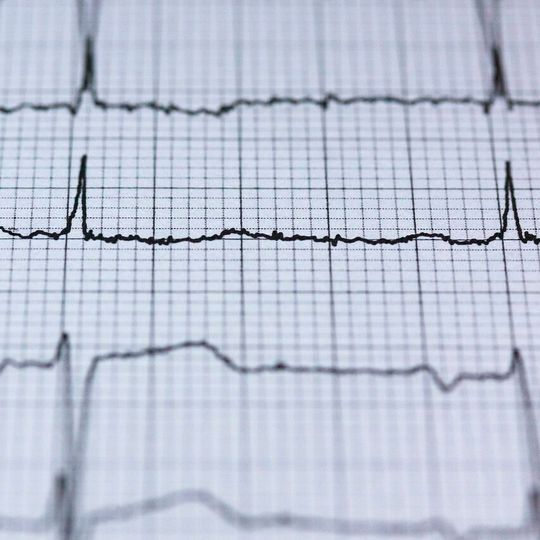 The heart is driven by electrical activity, so anything affecting its electrical properties can have a detrimental impact and possibly result in arrhythmias.(Source:  frei lizenziert /  Pixabay)