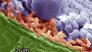 Das eingefärbte Bild aus dem Kryo-Rasterelektronenmikroskop zeigt die Eiskristalle (lila), die sich auf einem Tulpenblatt gebildet haben. Die wachsartige Schicht (braun) auf der Oberfläche schützt das darunterliegende Blatt (grün). (Bild: Stanislav Gorb)