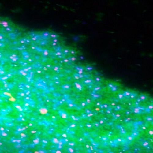 Fluorescence image of a Caulobacter biofilm. Live cells are labelled in green, dead ones in pink, and extracellular DNA release during cell death is shown in blue. Fluorescence image of a Caulobacter biofilm. Live cells are labelled in green, dead ones in pink, and extracellular DNA release during cell death is shown in blue.