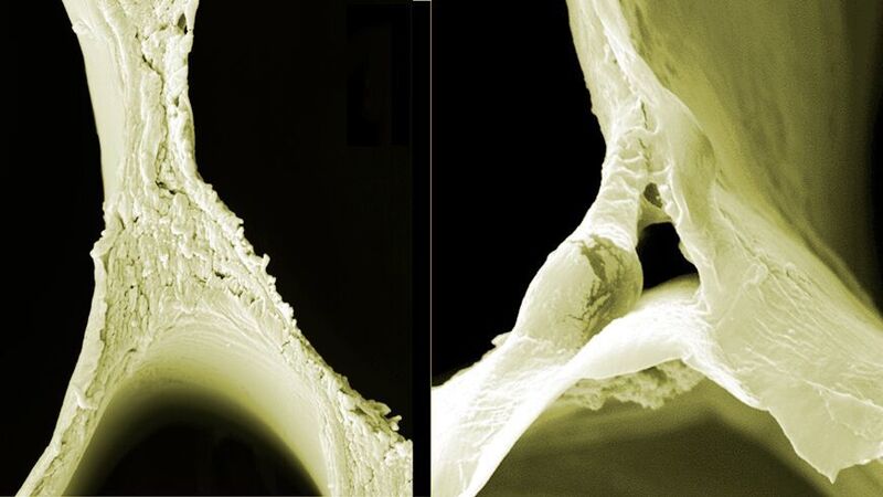Elektronenmikroskopie-Aufnahmen von Balsa-Holz (links) und delignifiziertem Balsa-Holz (rechts) zeigen die Veränderungen in der Struktur.  
 (ACS Nano / Empa)