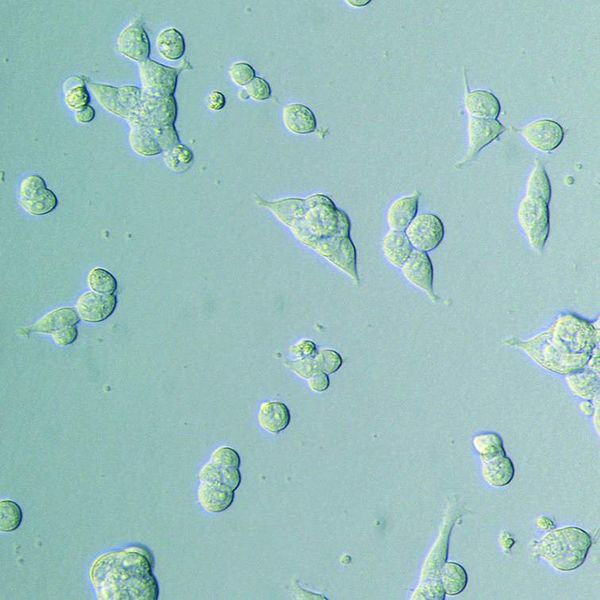 Abb. 2: Adhärenz und Morphologie: HEK-293-Zellen wurden in einer 96-Well-Platte ausgesät und in Serum-freiem Medium kultiviert (37 °C, 5% CO2). Nach 48 Stunden sind die Zellen auf der Standard-Zellkulturoberfläche nur semi-adhärent. (Archiv: Vogel Business Media)