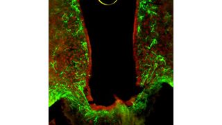 HDAC5 (rot) spielt in Nervenzellen eine wichtige Rolle für die Kontrolle der Nahrungsaufnahme, umliegende Astrozyten sind in grün eingefärbt.  (Helmholtz Zentrum München)