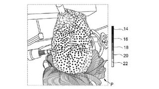 Medizinisches System sowie Verfahren zur Überprüfung einer Registrierungsgenauigkeit (Bild: B. Braun New Ventures GmbH/DPMA)