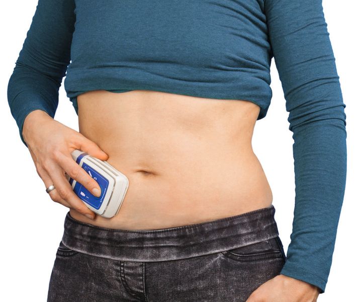 Die Patch-Pumpe SC-2-Wear wird am Körper getragen. Das Gerät erlaubt eine Selbstmedikation unter ärztlicher Kontrolle – immer und überall. (Bühler Motor)
