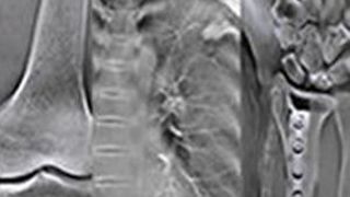 p4 (Shimadzu Deutschland GmbH)