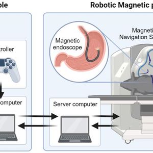 Diese Abbildung zeigt, wie eine ferngesteuerte Endoskopie funktioniert. (Bild:  Wiley, Advanced Intelligent Systems)