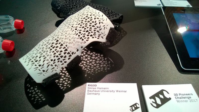 Gewinner der 3D Pioneers Challenge in der Kategorie Medizintechnik: Niklas Hamann; Bauhaus Universität Weimar mit RiG3D (Orthese). Die Orthese ist neben der anatomischen Individualisierung auch an das spezifische Krankheitsbild ihres Trägers angepasst. (Bild: D.Quitter/konstruktionspraxis)
