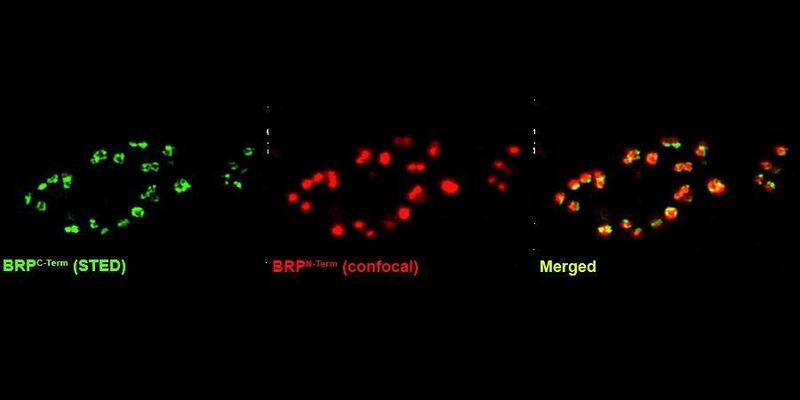 Vergleich zwischen konventioneller, konfokaler und STED-Mikroskopie. Darstellung der Verbindung einer Nervenzelle mit einem Muskel der Fruchtfliege Drosophila melanogaster, immunohistologisch gefärbt mit Antikörper gegen das synaptische Protein DLiprin-aGFP. Substrukturen kommen in der STED-Mikroskopie zum Vorschein (Auflösung: 80 nm), die mit Hilfe konventioneller Konfokalmikroskope nicht erkennbar sind (Auflösung: 250 nm, siehe Pfeilspitzen).  (Bild: Prof. Dr. Sigrist)