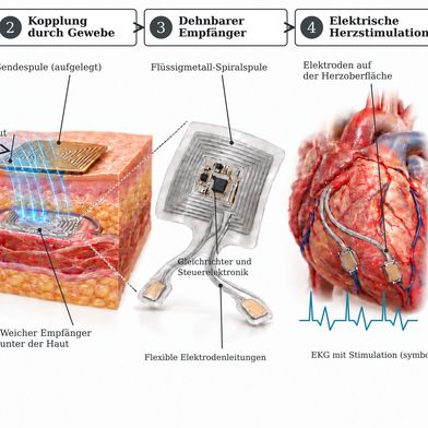 Die Illustration soll den Vorgang deutlich machen: Energie gelangt vom tragbaren Sender durch die Haut zum weichen Implantat, das Elektroden auf dem Herzen versorgt. Im Versuch trug ein frei bewegliches Schwein den Sender. (Bild: KI-generierte Illustration, nicht maßstabsgetreu; Motiv nach Angaben in Nam et al. [1])