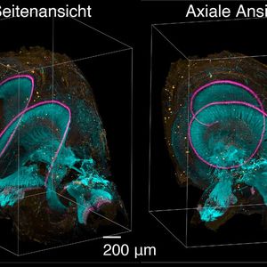 Hörschnecke eines menschlichen Innenohrs sichtbar gemacht mit dem neuartigen Lichtblatt-Fluoreszenzmikroskop(Bild:  Adaptiert nach Aakhte, M. et al., Nature Biotechnology, DOI: 10.1038/s41587-025-02882-8; lizensiert nach CC BY 4.0)