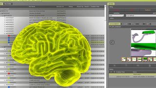 20220302-quality-monitor-vorschaubild (invenio AG)