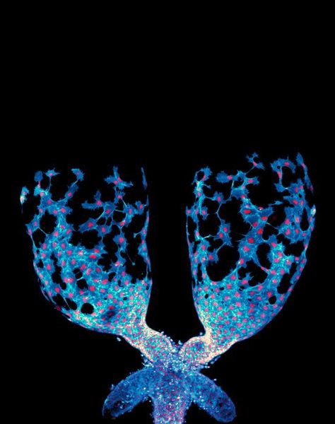 Organwanderung von Zellen Eine neue Studie der Universität von North Carolina in Chapel Hill hat enthüllt, dass die Zellen, die unsere Organe formen, erheblich mobiler und koordinierter agieren, als bisher angenommen. Durch Experimente mit Fruchtfliegen entdeckten die Forscher, dass sich künftige Muskelzellen über die Oberfläche des sich entwickelnden Hodens bewegen und so aktiv seine Form gestalten. Interessanterweise nutzen diese Zellen ein Kommunikationssystem, das normalerweise bei der Gehirnentwicklung zum Einsatz kommt, um ihre Bewegungen aufeinander abzustimmen. Die Studie zeigt, dass vor allem dynamische mesenchymale Zellen hervor übersehen werden. Diese Zellen, die im Gegensatz zu den bislang als zentral angesehenen statischen epithelialen Zellen stehen, zeigen bemerkenswerte Flexibilität und Einfluss bei der Organbildung.  Dank der Echtzeit-Live-Bildgebung konnten die Forscher diese faszinierenden Prozesse detailliert verfolgen. Eines der aufgenommenen Bilder zeigt einen Hoden ex vivo, auf dessen Oberfläche sich im Hoden entstehende Myotuben (TNMs) bewegen. Diese TNMs sind Vorläufer von Muskelfasern und spielen eine entscheidende Rolle bei der Formung der Organstruktur, indem sie aktiv und koordiniert ihre Position verändern. Die gewonnenen Erkenntnisse bieten potenziell neue Perspektiven auf Entwicklungsstörungen und könnten darüber hinaus unser Verständnis darüber vertiefen, wie Krebs, der ebenfalls von mesenchymalen Zellen beeinflusst wird, wächst und sich verbreitet. Hier gehts zur Originalmeldung Wissenschaftsbild des Tages vom 26.6.2025  (Bild: Dr. Maik Bischoff)