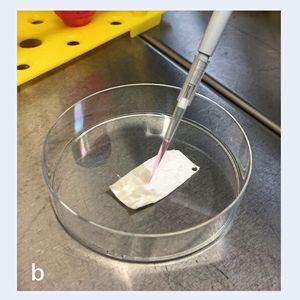 Die Kollagenmembran wird mit den patienteneigenen Knorpelzellen besiedelt.(Bild:  TERM / UKW)