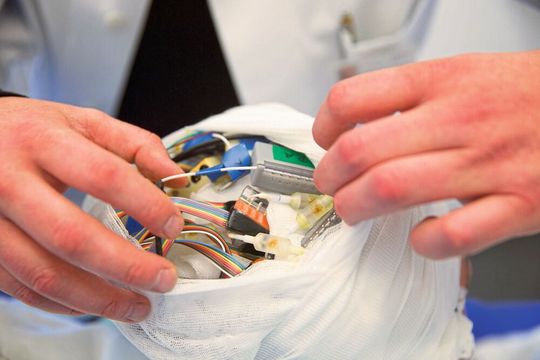 Für die Studie wurden winzige Elektroden in die Gehirne - von fünf Frauen und vier Männern implantiert, um die Aktivität einzelner Nervenzellen zu messen.  Foto: (Bild:  © Christian Burkert/Volkswagen-Stiftung/Uni Bonn)