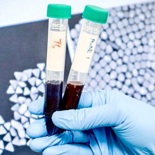 By tagging nanoparticles with unique DNA “barcodes”, the NUS research team was able to track and compare dozens of designs simultaneously in living tumor models, rapidly identifying those most effective at reaching mitochondria (energy centres inside cancer cells).(Source:  NUS)