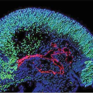 Organoidmodelle mit einer teils verblüffenden Ähnlichkeit zu echten embryonalen Geweben: Gehirn-Organoid mit Blutgefäßen (rot) und Gehirnstammzellen (grün)