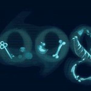 Google-Doodle vom 8. November 2010 zur Entdeckung der Röntgenstrahlung 
