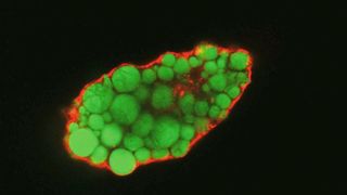 Lipidtropfen (angefärbt) in einer Fettzelle ohne EHD2. (Claudia Matthäus, MDC)