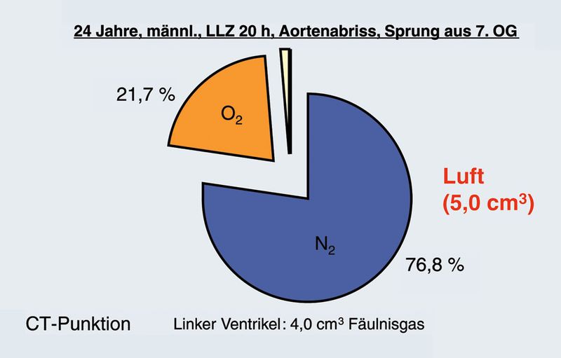 Abb.8: Luft bei geöffnetem Körper. (Archiv: Vogel Business Media)