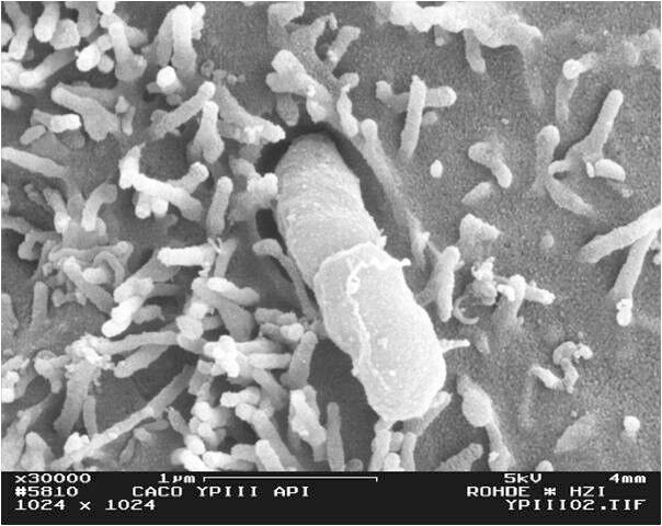 Yersinia pseudotuberculosis auf einer eukaryotischen Zelle  (Bild: HZI / Manfred Rohde)