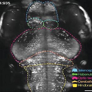 Abb. 4: Ein durch Lichtblatt-Mikroskopie dargestelltes Zebrafischgehirn einer sechs Tage alten Larve im Neuroexaminer. Aktive Nervenzellen der Larve im Ruhezustand sind durch eine helle Fluoreszenz – hier in weißer Farbe dargestellt – erkennbar, wohingegen inaktive Nervenzellen nur eine schwache Färbung aufweisen. Die Mikroskopie erlaubt zudem die Unterscheidung von Hirnkompartimenten wie dem Vorderhirn (blaue Linie), dem Mittelhirn (magenta Linie), dem Klein- und Hinterhirn (orange bzw. gelbe Linie). Der Kopf der Fischlarve zeigt nach oben. Links und rechts befinden sich die großen Augen.(Bild:  Mattern, K., von Trotha, J.W., Erfle, P. et al. NeuroExaminer: an all-glass microfluidic device for whole-brain in vivo imaging in zebrafish. Commun Biol 3, 311 (2020))