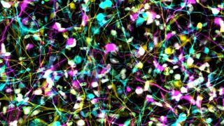 Die Abbildung zeigt induzierte Neuronen von Alzheimer-Patienten aus einer Immunfluoreszenz-Aufnahme. Die DNA-Schädigungen in diesen Nervenzellen sind durch grüne Punkte sichtbar.  (Jerome Mertens)
