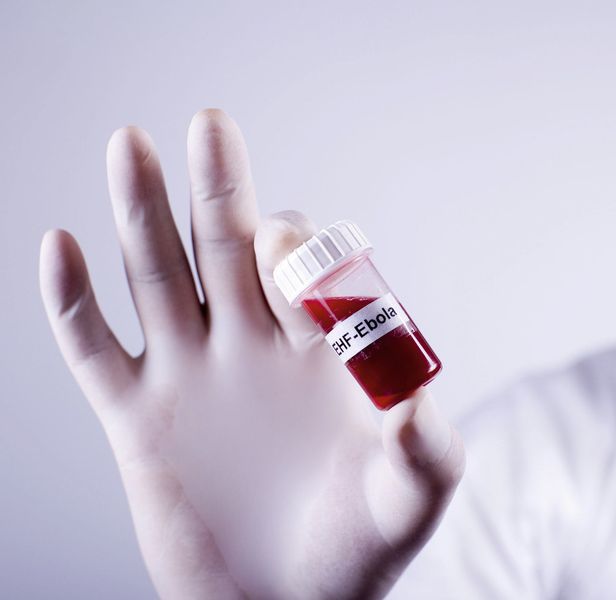 Abb. 1: Mit Ebolaviren kontaminierte Proben und Abfälle stellen besondere Anforderungen an ihren Transport und ihre Entsorgung. (© Aycatcher - Fotolia)