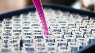 Auch wenn sich bei Brustkrebs die Prognose für die Patientinnen in den letzten Jahrzehnten deutlich verbessert hat, stellt metastasierter Brustkrebs immer noch eine große Herausforderung dar. Forschenden vom DKFZ und vom Heidelberger Stammzellinstitut HI-STEM ist es nun erstmals gelungen, direkt aus Blutproben von Brustkrebspatientinnen stabile Tumor-Organoide zu kultivieren und Tumorzellen in Laborexperimenten gezielt auszuschalten. (Symbolbild)  (Bild: frei lizenziert)