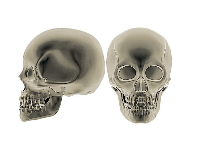 Passgenaue Implantate aus dem 3D-Drucker eröffnen neue Möglichkeiten in der Medizintechnik. (SLM Solutions)