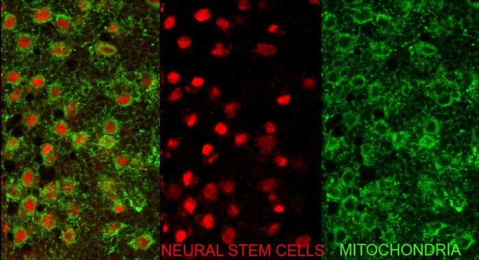 Mitochondrien und Mikrozephalie  Forscher des Institute for Research in Biomedicine in Barcelona haben den zellulären Mechanismus identifiziert, der erklärt, warum bestimmte Fehler bei der Chromosomenteilung zu Mikrozephalie führen können – einem Zustand, bei dem sich das Gehirn zu einer unterdurchschnittlichen Größe entwickelt. Die Studie konzentriert sich auf eine seltene Krankheit namens Mosaic Variegated Aneuploidy MVA.   Um den Ursprung dieser Symptome zu untersuchen, nutzte das Team die Fruchtfliege als Modell. Bei Fliegen wie beim Menschen entsteht das Gehirn aus neuralen Stammzellen, die sich teilen und Neuronen sowie Gliazellen bilden. Durch die Elimination von Genen, die für die korrekte Verteilung der Chromosomen in diesen Stammzellen verantwortlich sind, gelang es den Forschern, die bei Patienten beobachtete Mikrozephalie zu reproduzieren. Im Bild zu sehen sind neurale Stammzellen (in Rot) und ihr mitochondriales Netzwerk (in Grün). Die Studie deckt auf: Defekte Mitochondrien, die nicht entsorgt werden, stören die Zellteilung und können Mikrozephalie verursachen   Hier gehts zur Originalmeldung Wissenschaftsbild des Tages vom 2.4.2026  (Bild: IRB Barcelona)