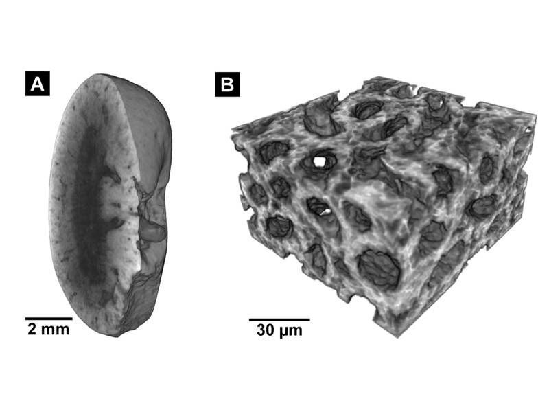 Diese Aufnahmen wurden durch die neue Färbemethode möglich: Links: Micro-CT-Aufnahme einer Mausniere, rechts: Nano-CT-Aufnahme des Gewebes.  (Müller, Pfeiffer / TUM / reproduced with permission from PNAS)