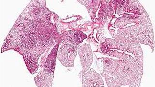 Lungenschnitt nach Ko-Infektion durch Influenza A-Viren und Pneumokokken. Die Färbung zeigt die ausgeprägte Entzündungsreaktion: Die entzündeten Areale der Lunge mit vielen eingewanderten Immunzellen sind als dunkle Verfärbungen zu erkennen. (© HZI)