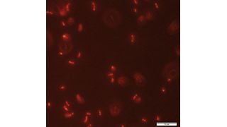 Abb. 1: Mit Nilrot gefärbte Zelle Rhodospirillum rubrum mit dem Fluoreszenzmikroskop beobachtet (Vergrößerung 100x). (Bild: S. Karmann, HES-SO Valais - Wallis)