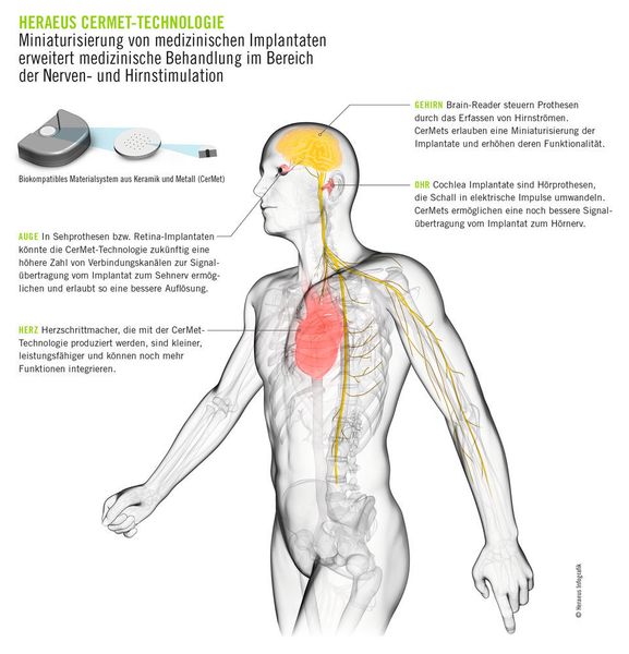 Die Cermet-Technologie von Heraeus ermöglicht neue Anwendungen in der minimalinvasiven Chirurgie für Herz, Gehirn, Auge und Ohr. (Bild: Heraeus)