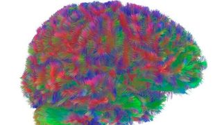 A representative MRI tractography image of the first era of the human brain. This image is representative of the general pattern seen across the brains in the study during the first era of neural wiring, between the ages of zero and nine.  (Source: Dr Alexa Mousley/ University of Cambridge)