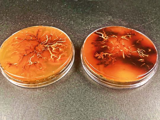 Pilzkultur von Armillaria cepistipes. Dunkle Areale enthalten besonders viel Melanin. Pilzkultur von Armillaria cepistipes. Dunkle Areale enthalten besonders viel Melanin.