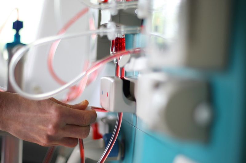 Dialysegeräte und Herz-Lungen-Maschinen sind ohne Durchflussmesser undenkbar. (© PA - Fotolia)