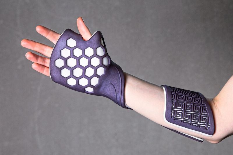 An den Patienten angepasste Unterarmorthese (FIT Additive Manufacturing)