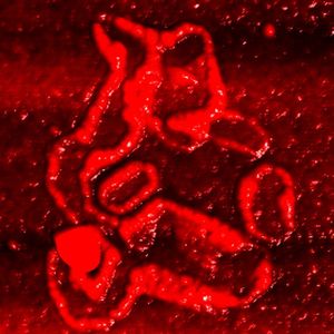 Proteinansammlungen auf roten Blutkörperchen bei einem Alzheimer-Patienten. AFM-Aufnahme, eingefärbt.