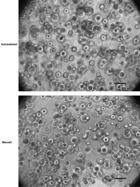 Humane Dickdarmkrebszellen (HCT-116) in biomimetisches Hydrogel eingebaut. Oben wurden die Zellen automatisiert und unten manuell verkapselt. Die Zellen wurden für acht Tage kultiviert. (Bild: Cellendes)