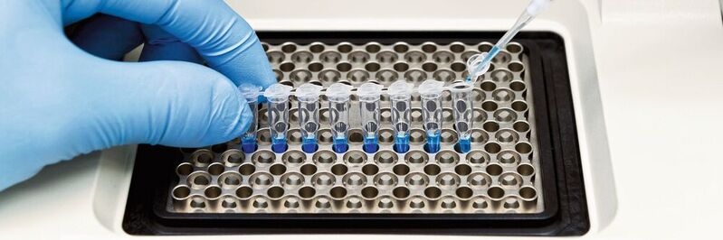 Laborproben: Bakterien und Viren lassen sich im Labor über einen PCR-Test (Polymerase-Kettenreaktion) aufspüren. Dabei muss die Temperatur präzise und berührungslos gemessen werden.