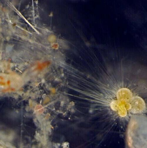 Plankton under a microscope. Researchers at UT Austin say that tropical plankton like this may vanish as the climate warms. Plankton under a microscope. Researchers at UT Austin say that tropical plankton like this may vanish as the climate warms.