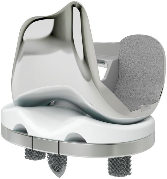 Das erste Teil, bei dem Lima Corporate im 3D-Druck die Gitterstruktur aus Trabecular Titanium einsetzte, war eine Hüftgelenkspfanne, die seit der Einführung im Jahr 2007 über 100.000 Mal gefertigt wurde.  (Bild: Siemens)