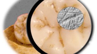 Die Dental Microwear Texture Analysis – die Zahnabnutzungsanalyse, die in der Studie verwendet wurde –, umfasst die Untersuchung und Analyse von winzigen Abnutzungsspuren auf der Zahnoberfläche im Größenbereich unter einem Mikrometer. (Bild: Sireen El Zaatari)