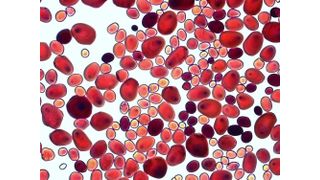 Abb. 1 Stärkekornfärbungen mit Lugols-Lösung. Isolierte Stärkekörner der Amylopektin-Kartoffel der LfL werden mit Lugols-Lösung rot-braun gefärbt. Der Grad der Färbung weist auf einen gleichmäßig hohen Gehalt von mehr als 99 Prozent Amylopektin in den Stärkekörnern. (Archiv: Vogel Business Media)