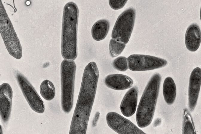 Das Bakterium Clostridium ljungdahlii unter dem Elektronenmikroskop.  (Bild: Sara Al Sbei/Leibniz-HKI und Martin Westermann/ EMZ Jena)