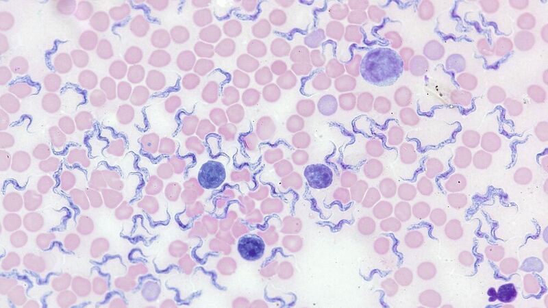 Abb.2: Mikroskopaufnahme eines Blutausstriches, der mithilfe der Giemsa-Färbung präpariert wurde (Aufnahme mit ZEISS Axiolab 5). (ZEISS Microscopy)