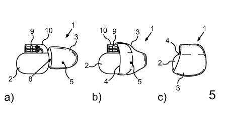 Eine Umhüllung zur Aufnahme eines Implantats sowie Verfahren zu dessen Herstellung.(Bild:  DPMA)