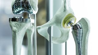 Was als Medizinprodukt gilt und was nicht, ist genau geregelt. (Hier: Knie- und Hüftprothese) (© Monstar Studio - stock.adobe.com)