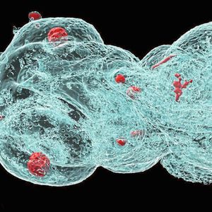 Kopfpartie eines Zebrafisch-Embryos. Rot gefärbt sind die Augenlinsen, Otolithen (also Kalksteinchen des Gleichgewichtsorgans) und rechts eine Anreicherung der Metall-Nanopartikel zu sehen.